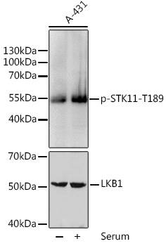 Anti-Phospho-LKB1 (Thr189) Rabbit pAb