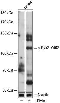 Anti-Phospho-PYK2 (Tyr402) Rabbit pAb