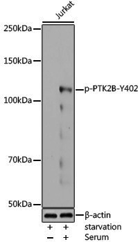 Anti-Phospho-PYK2 (Tyr402) Rabbit pAb