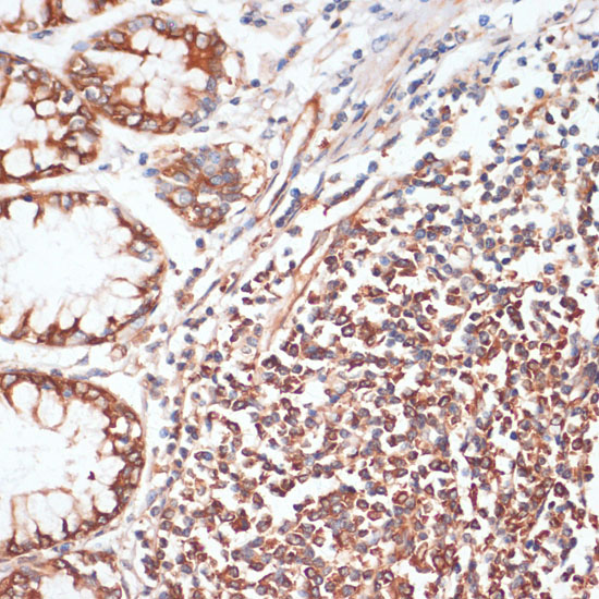 Anti-Phospho-VASP (Ser157) Rabbit pAb