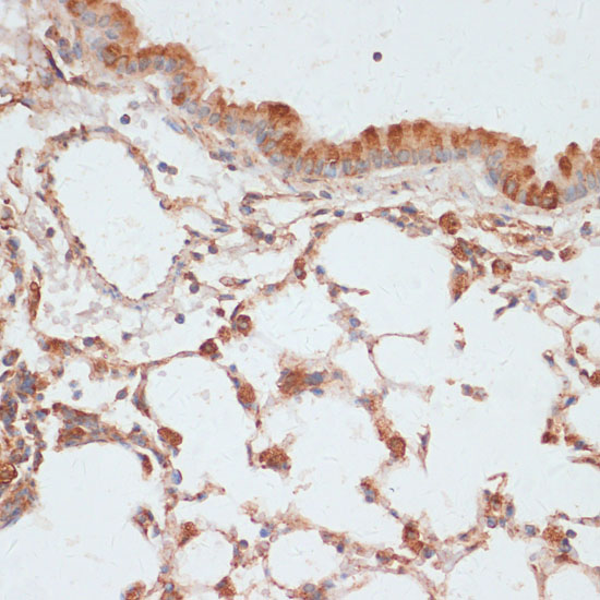 Anti-Phospho-VASP (Ser157) Rabbit pAb
