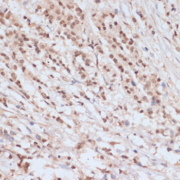 Anti-Phospho-BRCA1 (Ser1423) Rabbit pAb