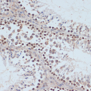 Anti-Phospho-BRCA1 (Ser1423) Rabbit pAb
