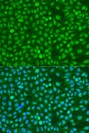 Anti-Phospho-BRCA1 (Ser1423) Rabbit pAb