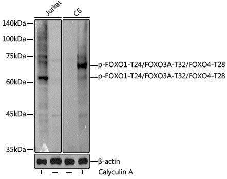 Anti-Phospho-FOXO1 (Thr24)/FOXO3A (Thr32)/FOXO4 (Thr28) Rabbit pAb