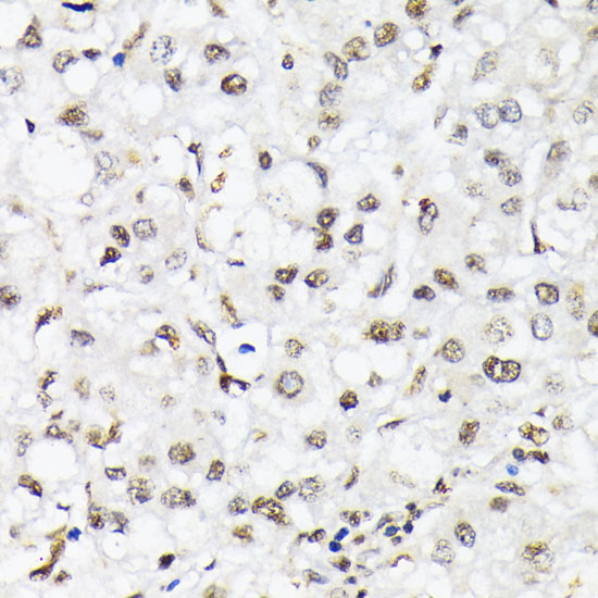 Anti-Phospho-FOXO1 (Thr24)/FOXO3A (Thr32)/FOXO4 (Thr28) Rabbit pAb