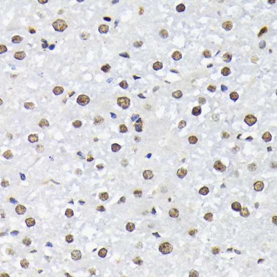 Anti-Phospho-FOXO1 (Thr24)/FOXO3A (Thr32)/FOXO4 (Thr28) Rabbit pAb
