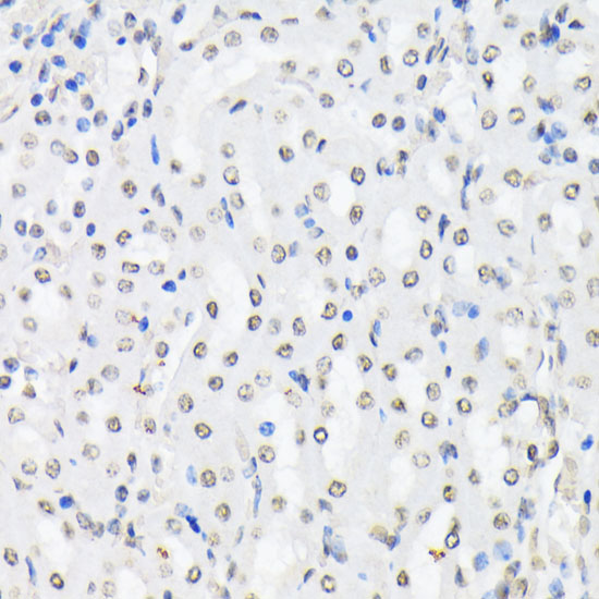 Anti-Phospho-FOXO1 (Thr24)/FOXO3A (Thr32)/FOXO4 (Thr28) Rabbit pAb