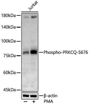 Anti-Phospho-PKC theta (Ser676) Rabbit pAb