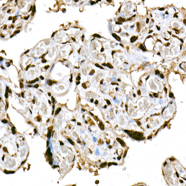 Anti-Phospho-HDAC4 (Ser246)/HDAC5 (Ser259)/HDAC9 (Ser220) Rabbit pAb