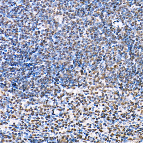 Anti-Phospho-HDAC4 (Ser246)/HDAC5 (Ser259)/HDAC9 (Ser220) Rabbit pAb