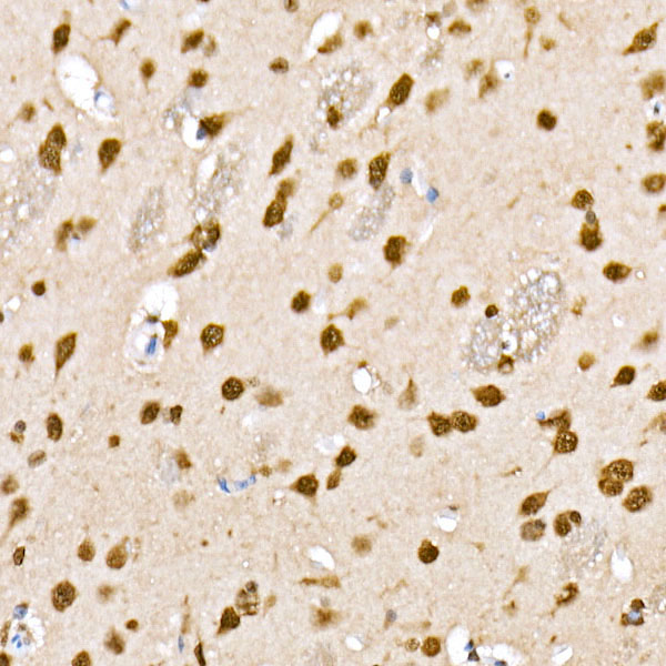 Anti-Phospho-HDAC4 (Ser246)/HDAC5 (Ser259)/HDAC9 (Ser220) Rabbit pAb