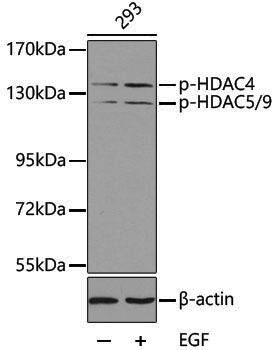 Anti-Phospho-HDAC4 (Ser246)/HDAC5 (Ser259)/HDAC9 (Ser220) Rabbit pAb