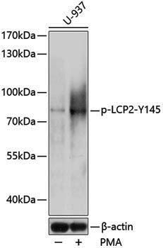 Anti-Phospho-SLP76 (Tyr145) Rabbit pAb