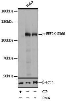 Anti-Phospho-EEF2K (Ser366) Rabbit pAb