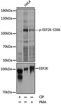 Anti-Phospho-EEF2K (Ser366) Rabbit pAb