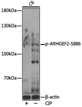 Anti-Phospho-GEF H1 (Ser886) Rabbit pAb