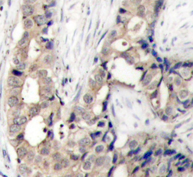 Anti-Phospho-ABL1 (Tyr412) Rabbit pAb