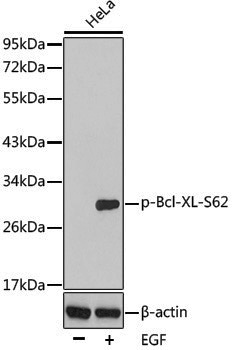Anti-Phospho-Bcl-XL (Ser62) Rabbit pAb