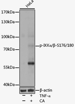 Anti-Phospho-IKK alpha/beta (Ser176/Ser180) Rabbit pAb