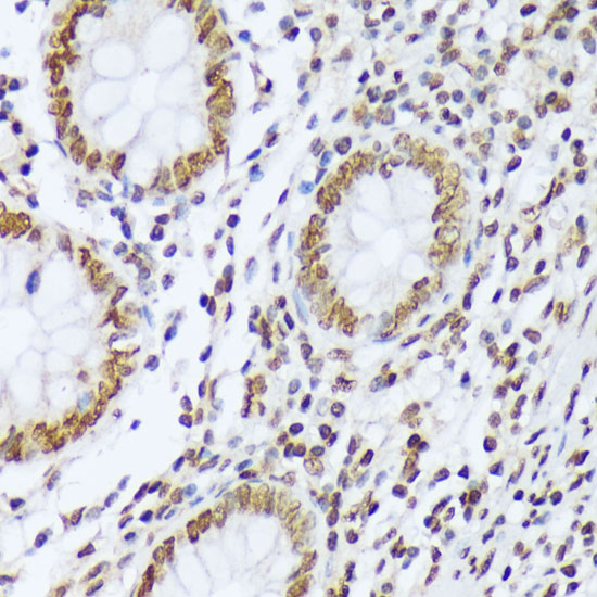 Anti-Phospho-ABL1 (Tyr412) Rabbit pAb
