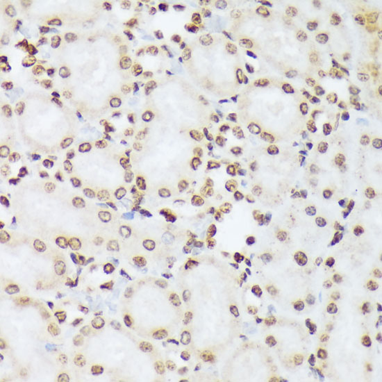 Anti-Phospho-ABL1 (Tyr412) Rabbit pAb