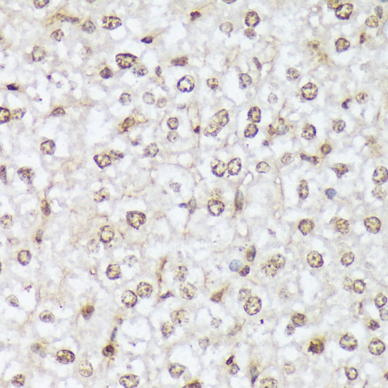 Anti-Phospho-ABL1 (Tyr412) Rabbit pAb