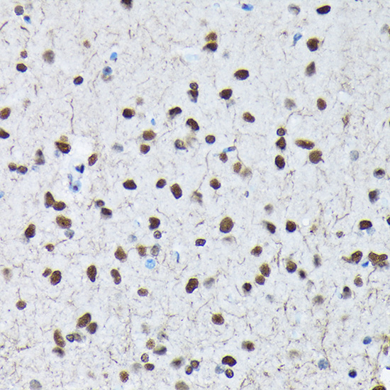 Anti-Phospho-c-Jun (Ser63) Rabbit pAb