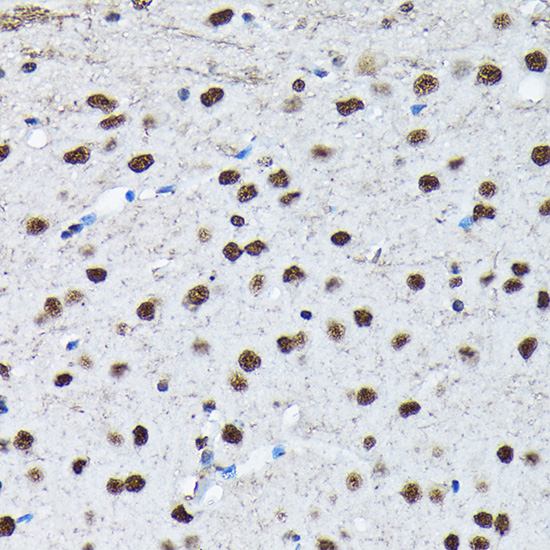 Anti-Phospho-c-Jun (Ser63) Rabbit pAb