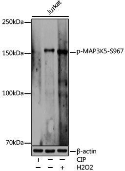 Anti-Phospho-MAP3K5 (Ser967) Rabbit pAb