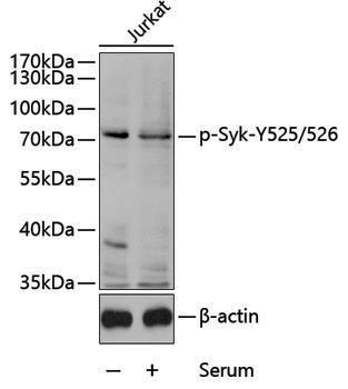 Anti-Phospho-Syk (Tyr525/Tyr526) Rabbit pAb