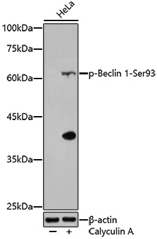 Anti-Phospho-Beclin 1 (Ser93) Rabbit pAb