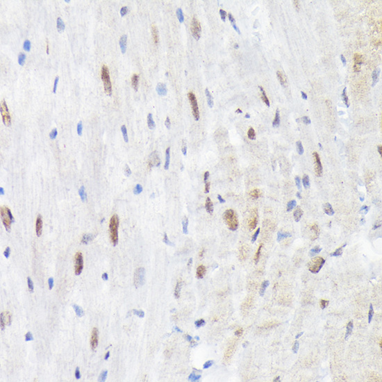 Anti-Phospho-p38 (Thr180) Rabbit pAb