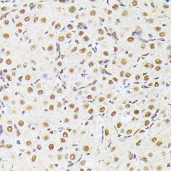Anti-Phospho-p38 (Thr180) Rabbit pAb