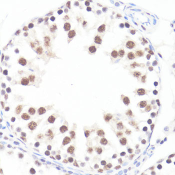 Anti-Phospho-c-Myc (Ser62) Rabbit pAb