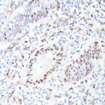 Anti-Phospho-c-Myc (Ser62) Rabbit pAb