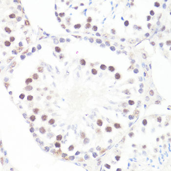 Anti-Phospho-c-Myc (Ser62) Rabbit pAb