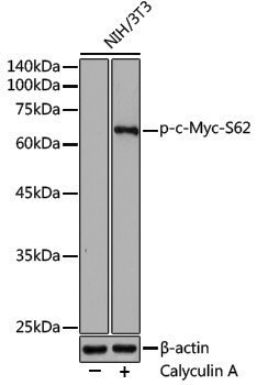 Anti-Phospho-c-Myc (Ser62) Rabbit pAb