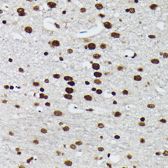 Anti-Phospho-c-Jun (Ser73) Rabbit pAb