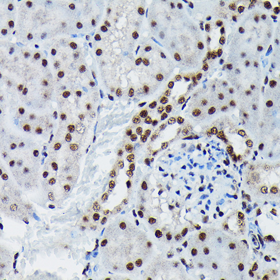 Anti-Phospho-c-Jun (Ser73) Rabbit pAb