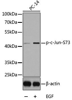 Anti-Phospho-c-Jun (Ser73) Rabbit pAb