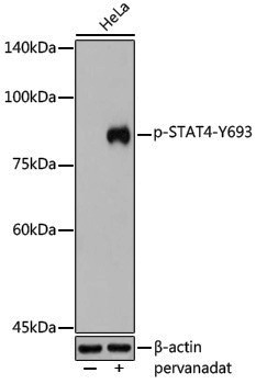 Anti-Phospho-STAT4 (Tyr693) Rabbit pAb