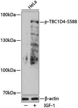Anti-Phospho-AS160 (Ser588) Rabbit pAb