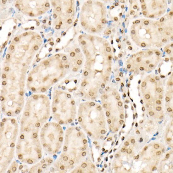 Anti-Phospho-Cofilin (Tyr139) Rabbit pAb