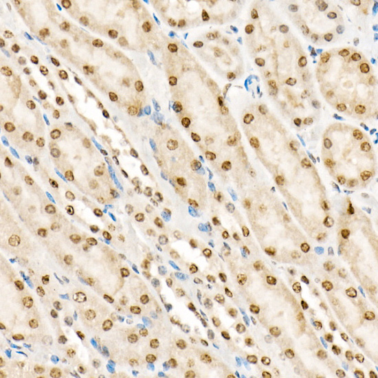 Anti-Phospho-Cofilin (Tyr139) Rabbit pAb