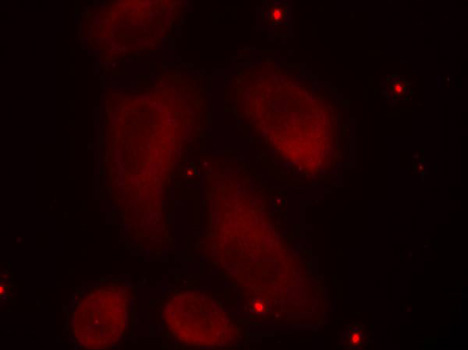 Anti-Phospho-LIM Kinase 1 (Thr508) Rabbit pAb