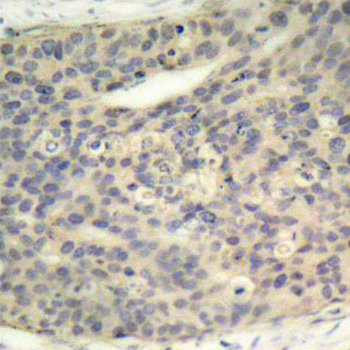 Anti-Phospho-LIM Kinase 1 (Thr508) Rabbit pAb