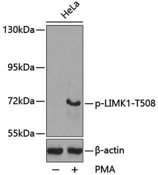 Anti-Phospho-LIM Kinase 1 (Thr508) Rabbit pAb