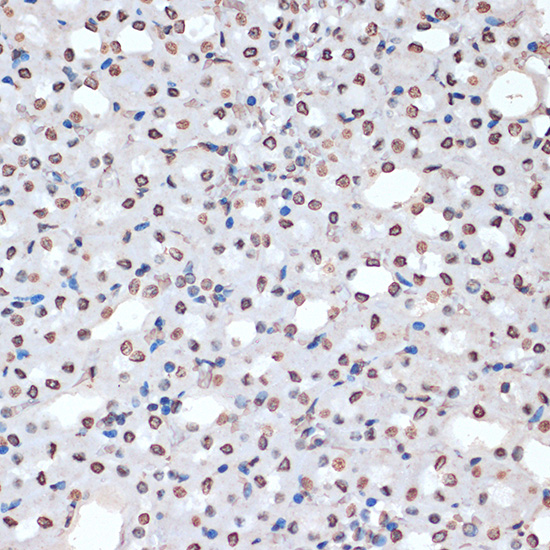 Anti-Phospho-MAPKAP Kinase 2 (Thr334) Rabbit pAb