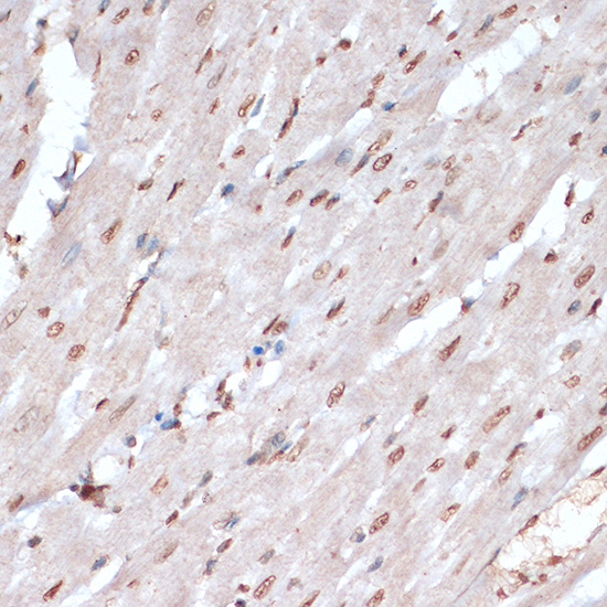 Anti-Phospho-MAPKAP Kinase 2 (Thr334) Rabbit pAb
